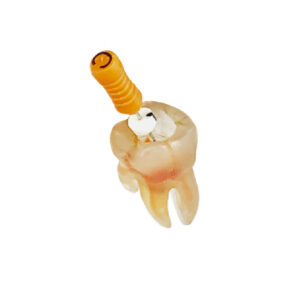 Molar Para Entrenamiento Bondent